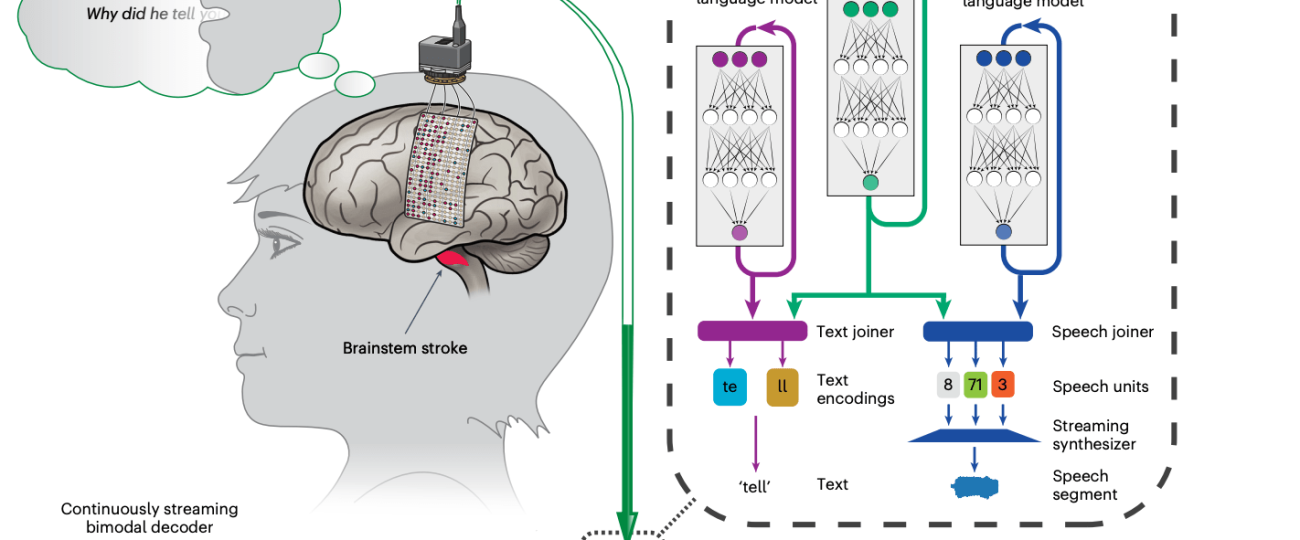 Brain implant helps woman with paralysis speak with her own voice again