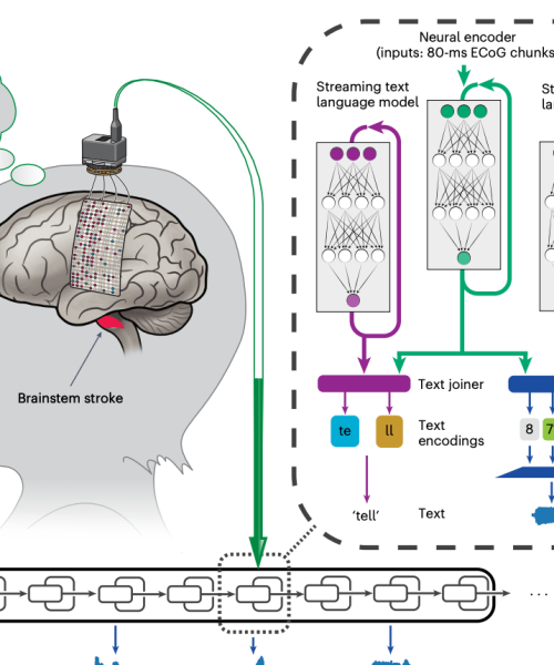Brain implant helps woman with paralysis speak with her own voice again