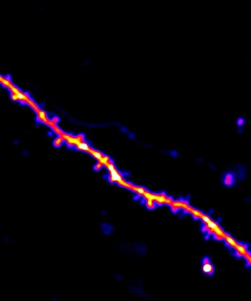 Scientists watch how mice learn, one synapse at a time