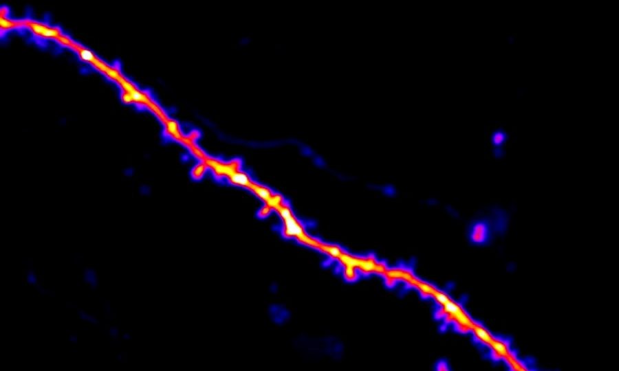 Scientists watch how mice learn, one synapse at a time