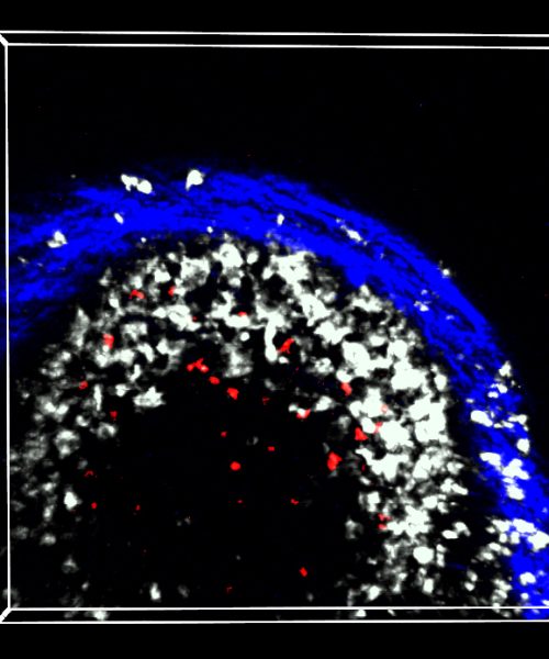 Why using the same arm for vaccines might boost the body’s response