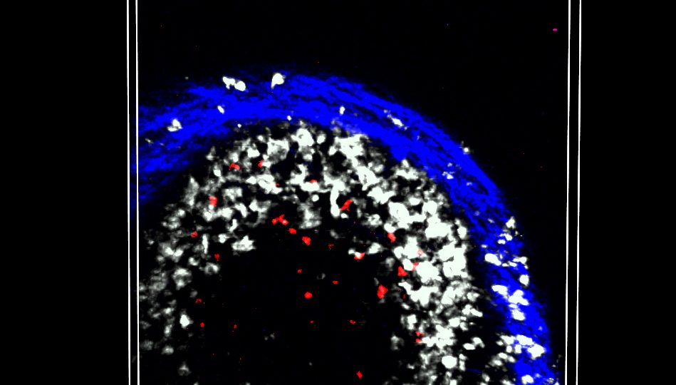 Why using the same arm for vaccines might boost the body’s response