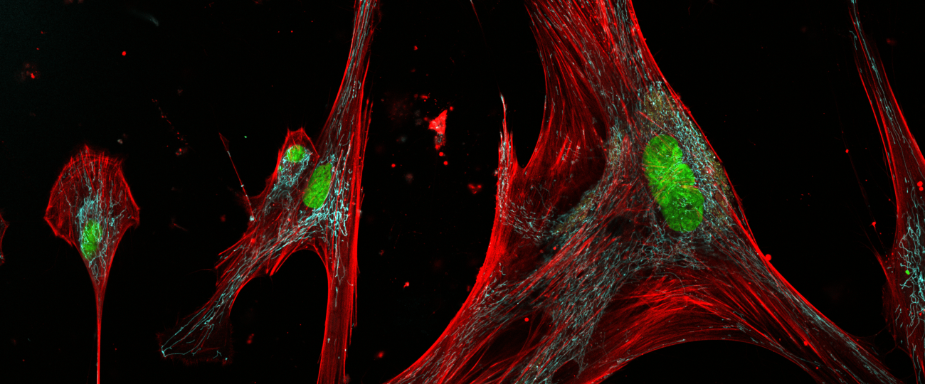Your skin is crawling with zombie cells–some help, some hurt