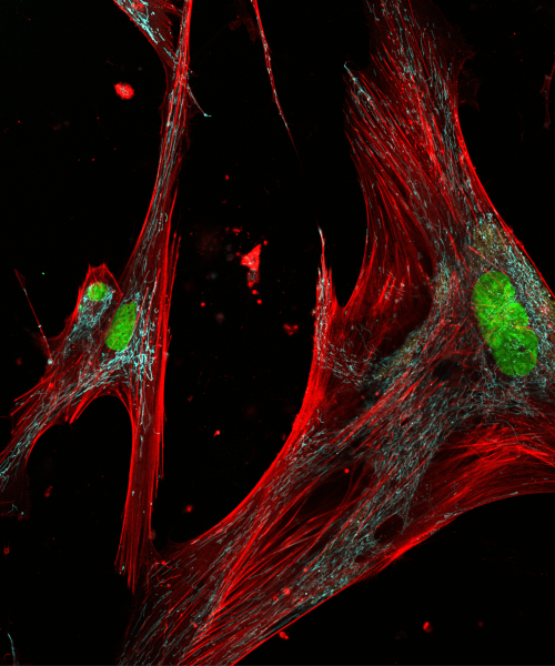 Your skin is crawling with zombie cells–some help, some hurt