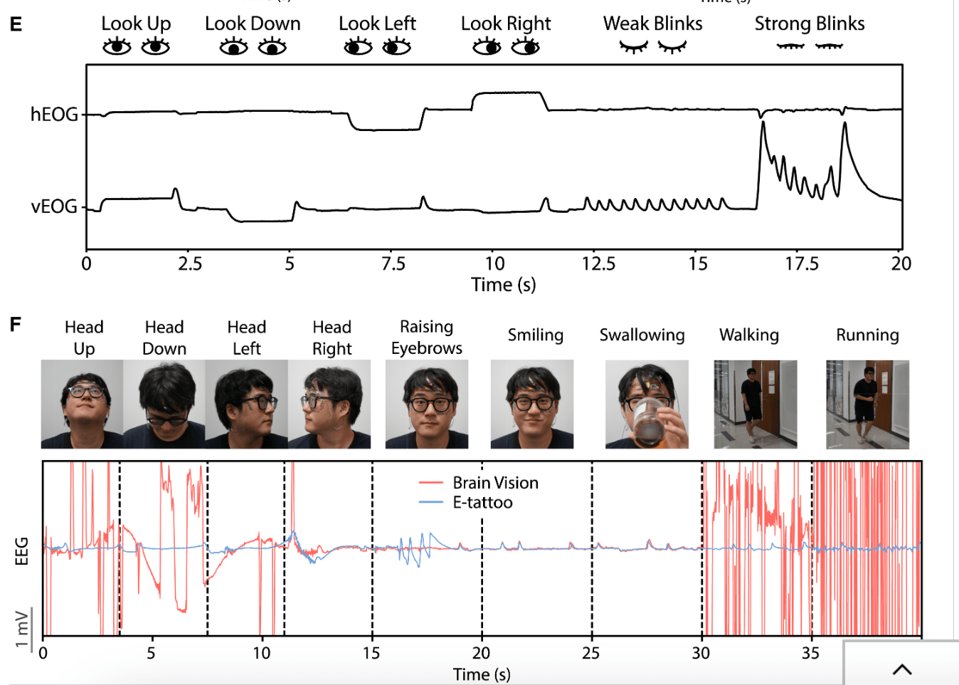 chart compairing e-tattoo and brain vision