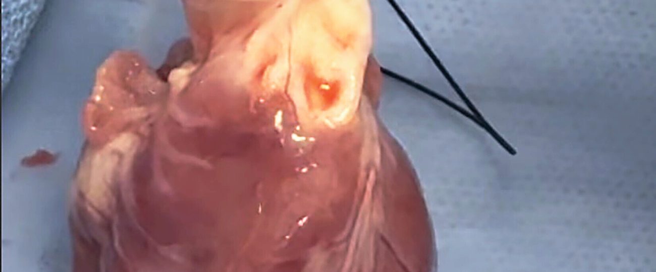 Surgeons develop 2 ways to ‘restart’ hearts without a donor’s body