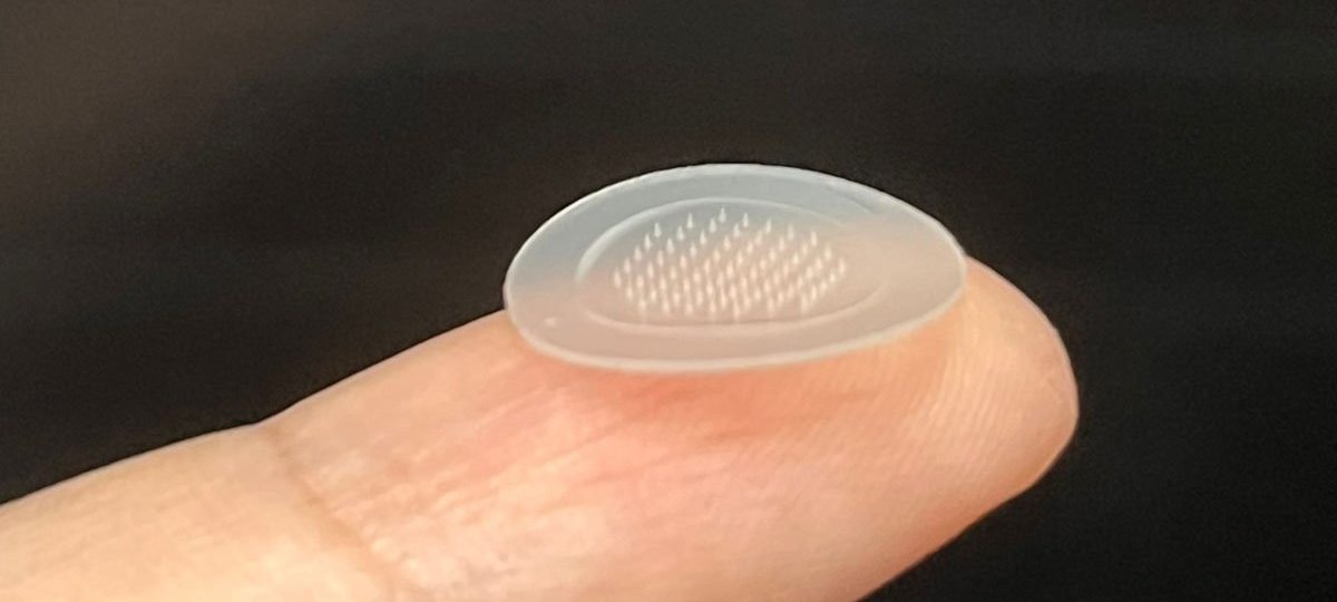 Researchers develop a pimple patch that actually seems to work