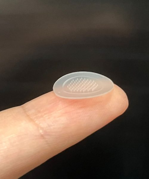 Researchers develop a pimple patch that actually seems to work