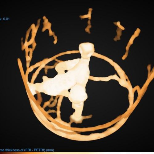 Ants ‘social distance’ during a pandemic