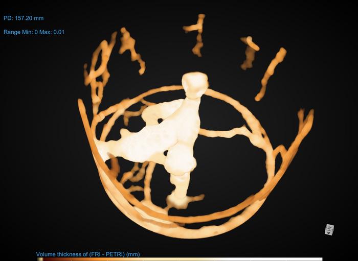 Ants ‘social distance’ during a pandemic