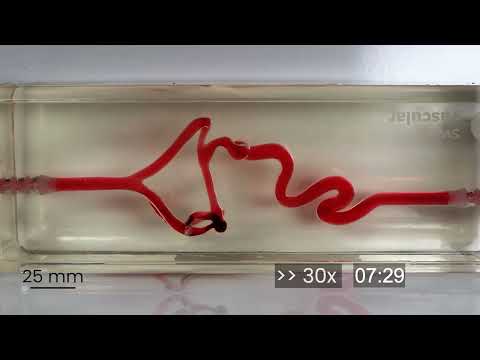 These tiny robots swim through your blood to fight strokes