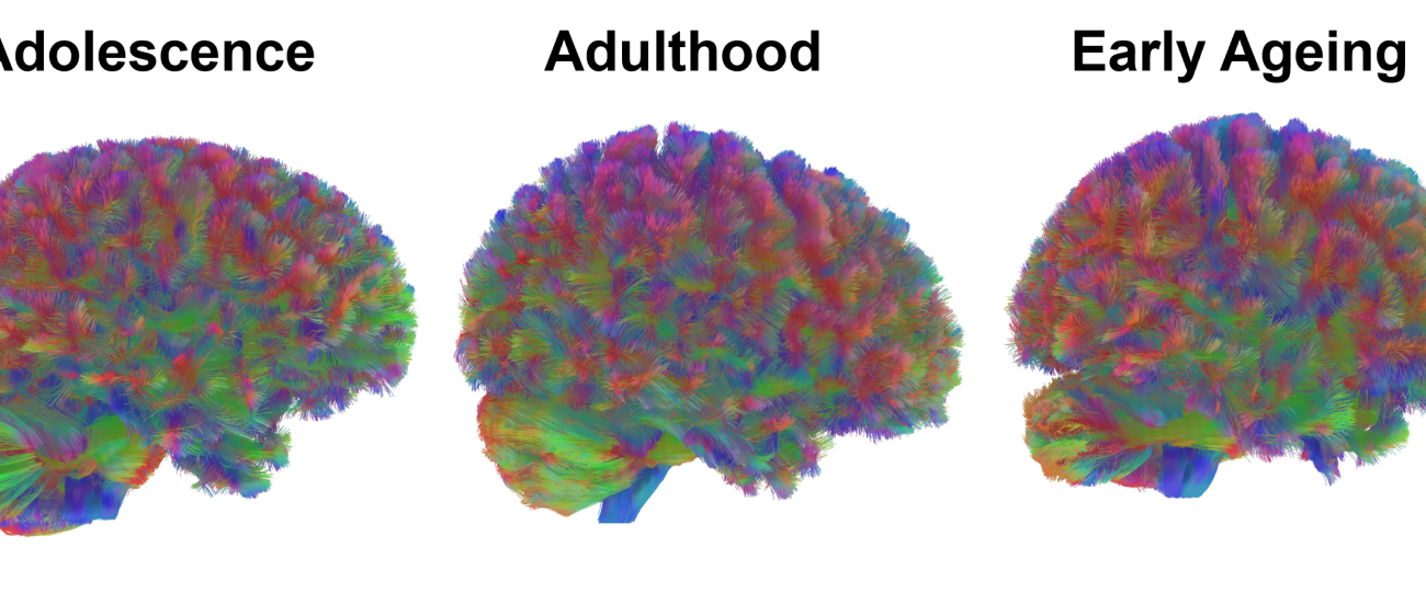 Your brain changes at 9, 32, 66, and 83