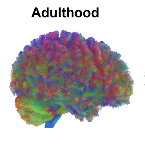 Your brain changes at 9, 32, 66, and 83