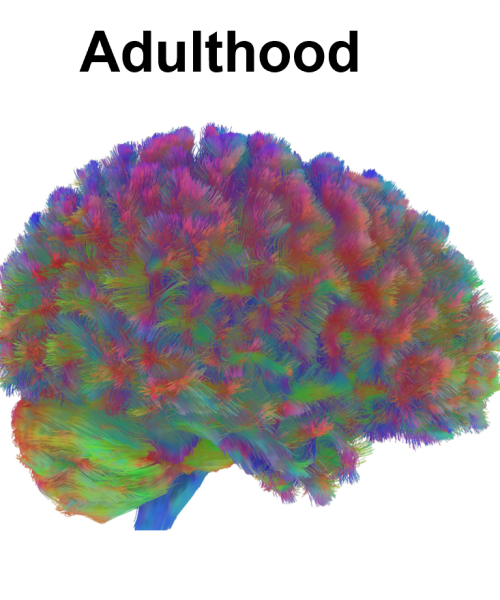 Your brain changes at 9, 32, 66, and 83