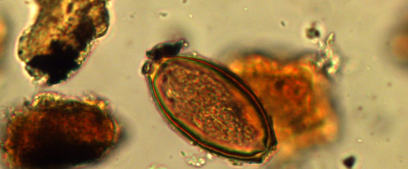 Diarrhea slowed down Roman soldiers