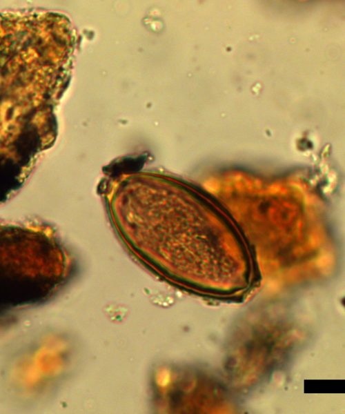 Diarrhea slowed down Roman soldiers