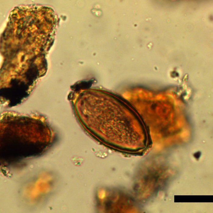 Diarrhea slowed down Roman soldiers