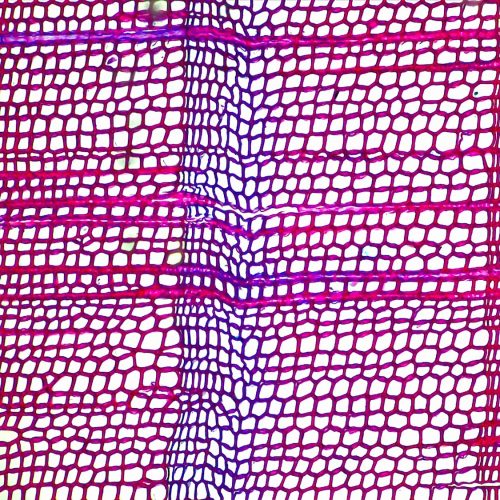 Medieval volcanoes may have ignited the Black Death