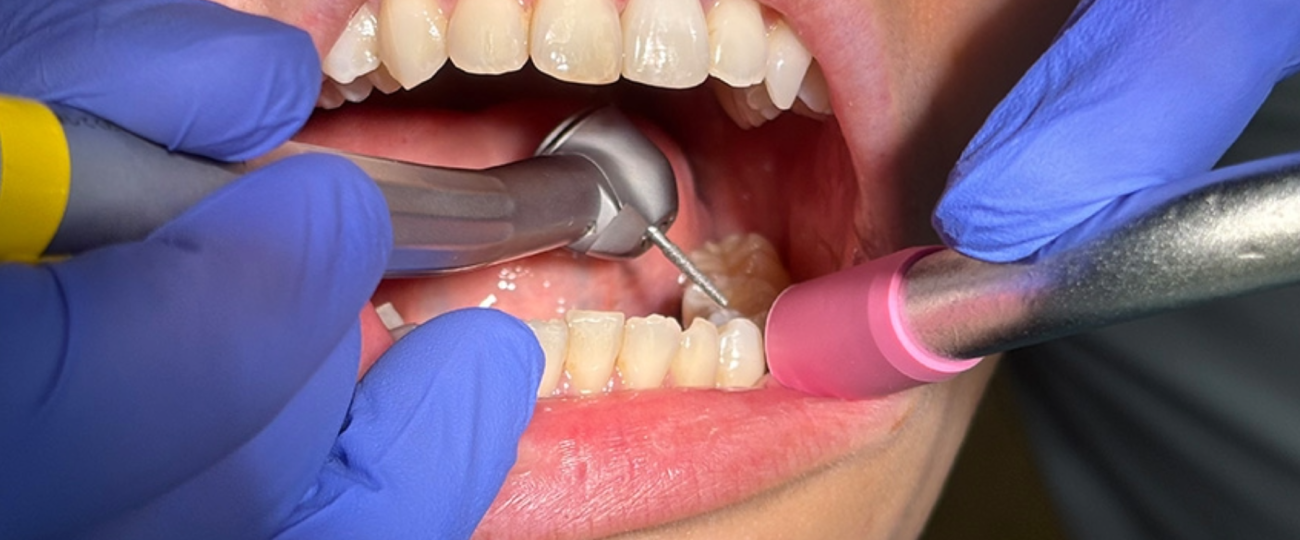 Quieter dental drills may be on the horizon