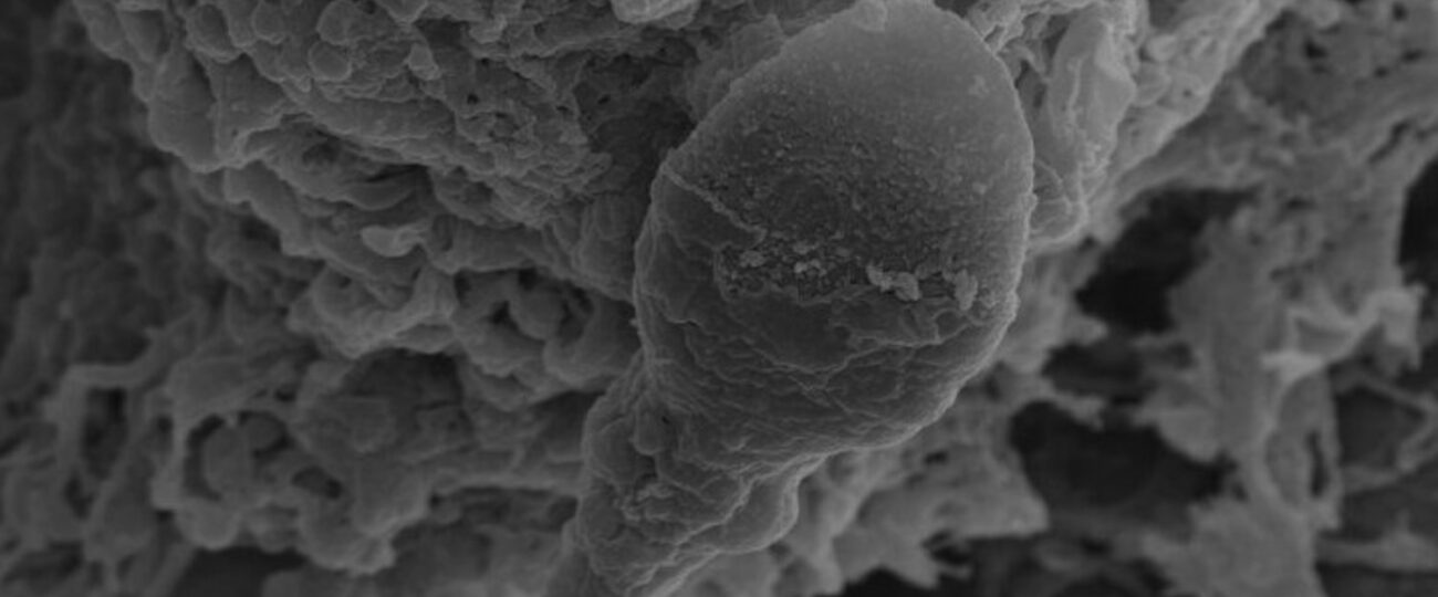 Sperm loses its sense of direction in space