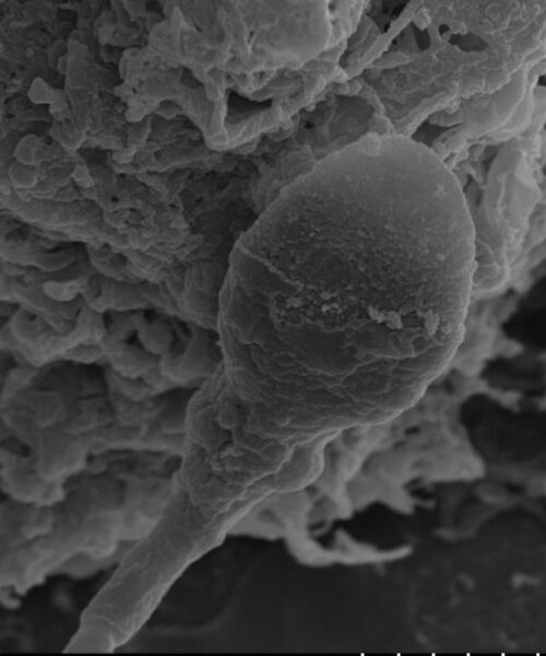 Sperm loses its sense of direction in space