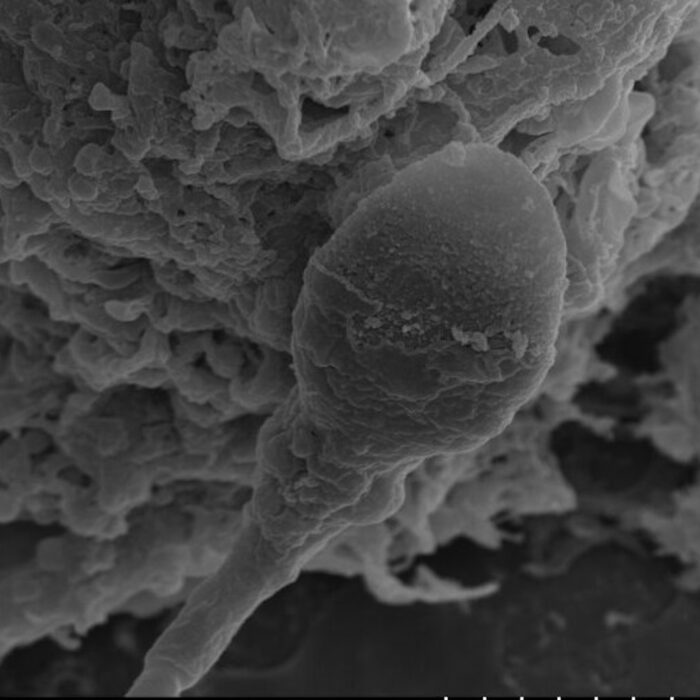 Sperm loses its sense of direction in space